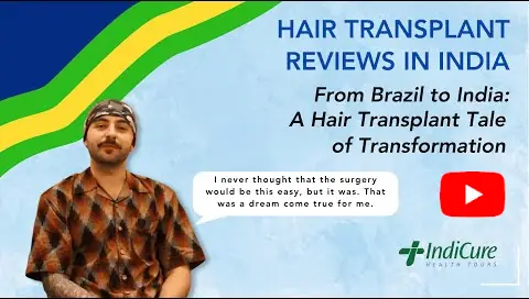 Learn how Diego from Brazil regained his confidence and transformed his appearance with a virtually painless hair transplant in India in his review with IndiCure.