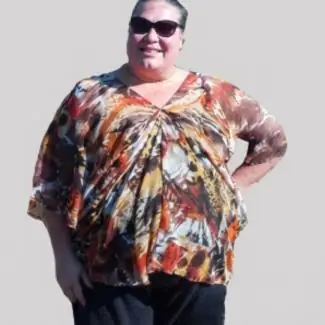 Thumbnail for bariatric surgery before after results