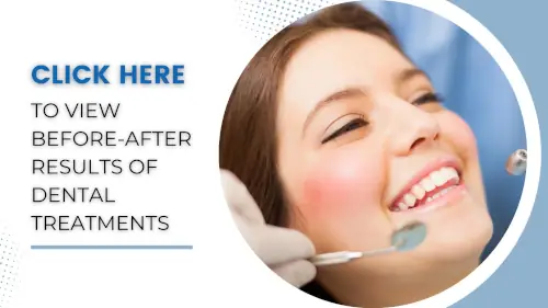 thumbnail for viewing before after results of dental treatment in India