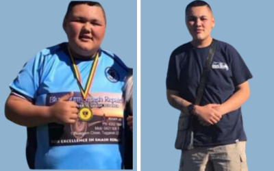Bariatric surgery before and after result 3 - weight loss surgery in India, IndiCure patient