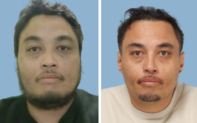 Bariatric surgery before and after result 8 - weight loss surgery in India, IndiCure patient