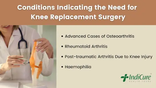 How to know if I need surgery for my knee
