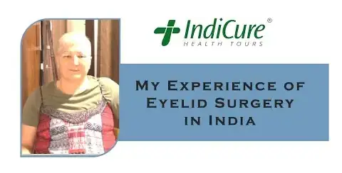Eyelid lift surgery in India