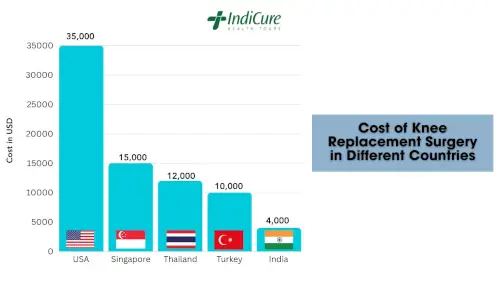 Cost of Knee Replacement Surgery in Different Countries