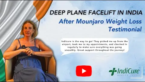 Deborah's Transformative Deep Plane Facelift Journey After Mounjaro Weight Loss