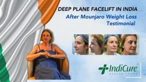 Deborah's Transformative Deep Plane Facelift Journey After Mounjaro Weight Loss