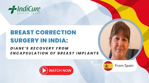 ms-diane-lawes-breast-implant-with-indicure