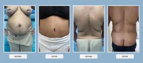 body-procedures-before-after-1