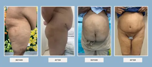 body-procedures-before-after